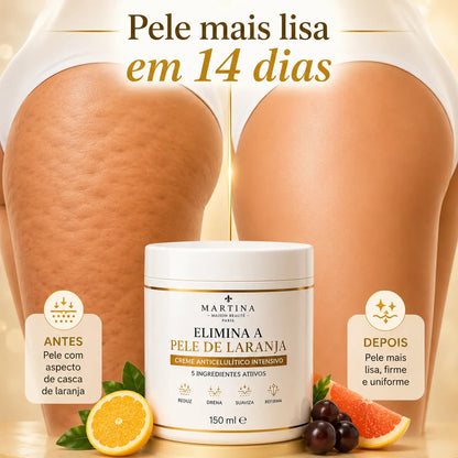 Creme Anticelulítico Intensivo™