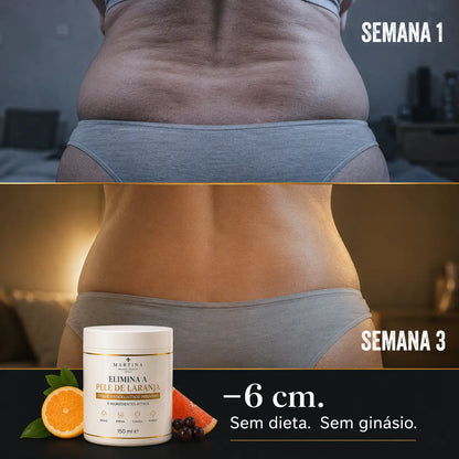 Creme Anticelulítico Intensivo™