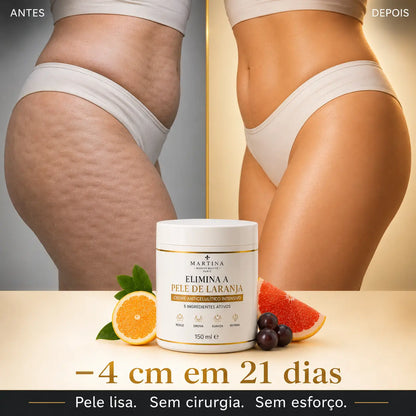 Creme Anticelulítico Intensivo™