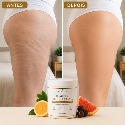Creme Anticelulítico Intensivo™