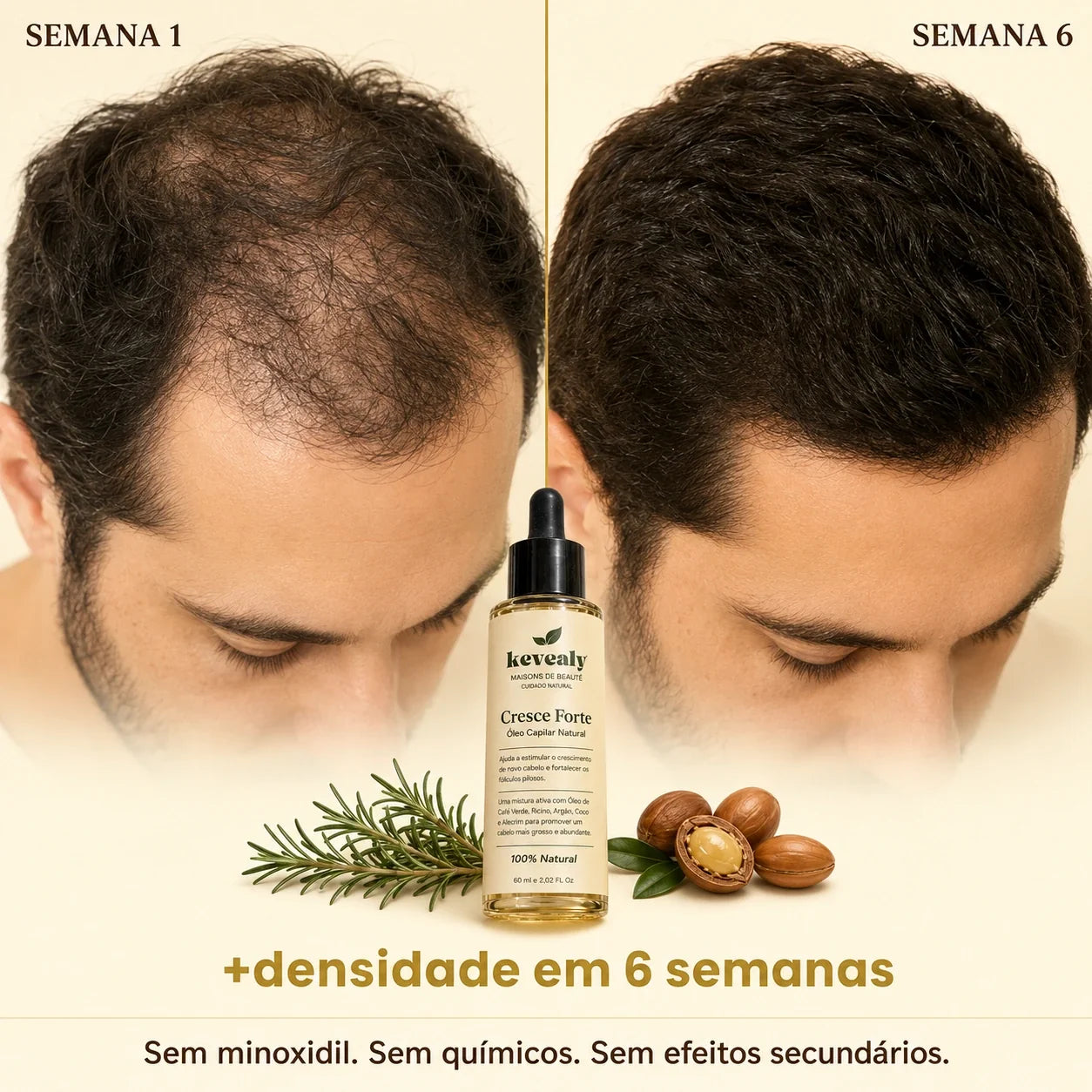 Cresce Forte™ | Óleo Capilar Natural