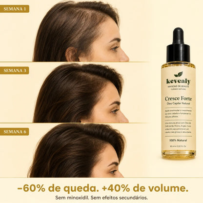 Cresce Forte™ | Óleo Capilar Natural