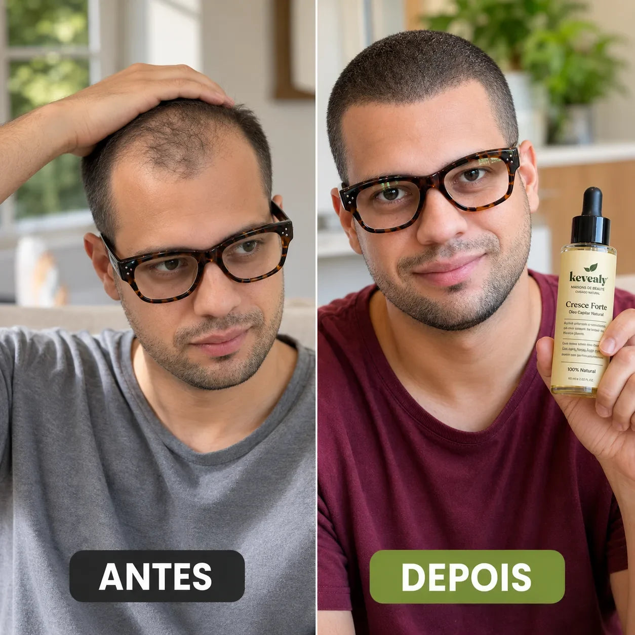 Cresce Forte™ | Óleo Capilar Natural