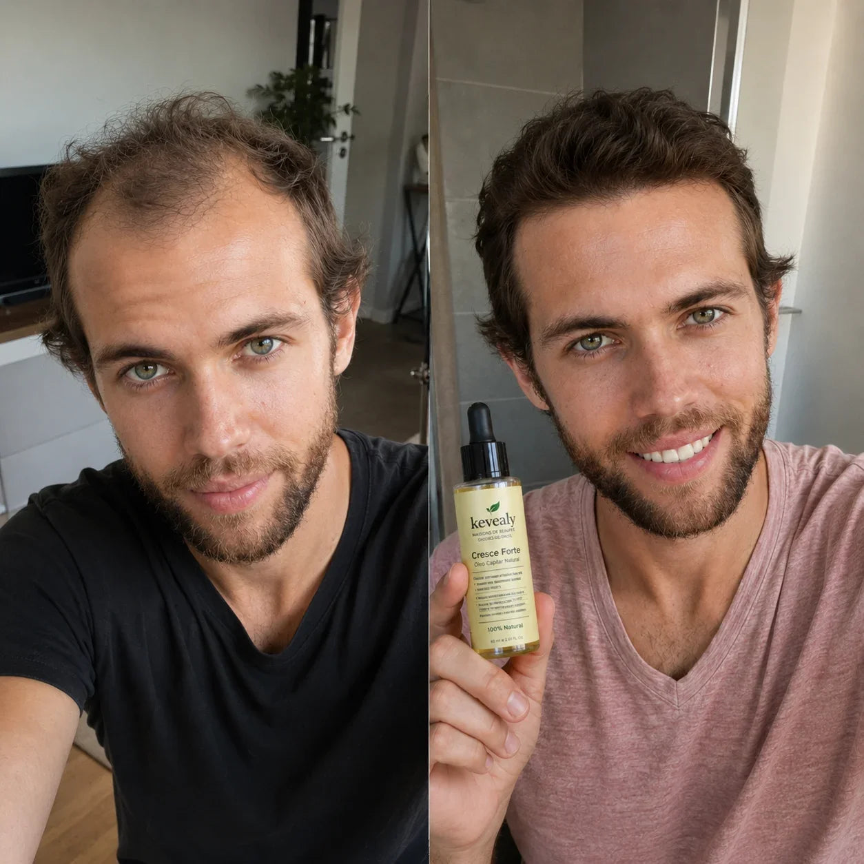 Cresce Forte™ | Óleo Capilar Natural